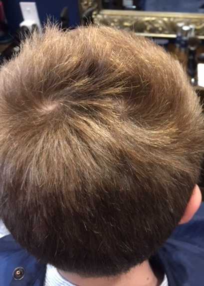 Cowlick Hair: Explanatory Guide With Tips And Tricks | MensHaircuts